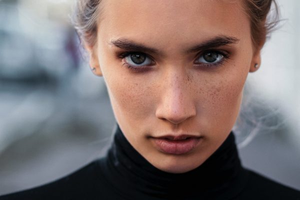 Eyebags and Tear Trough Treatment