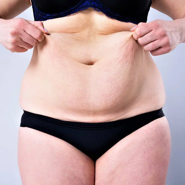 A woman's obese body.