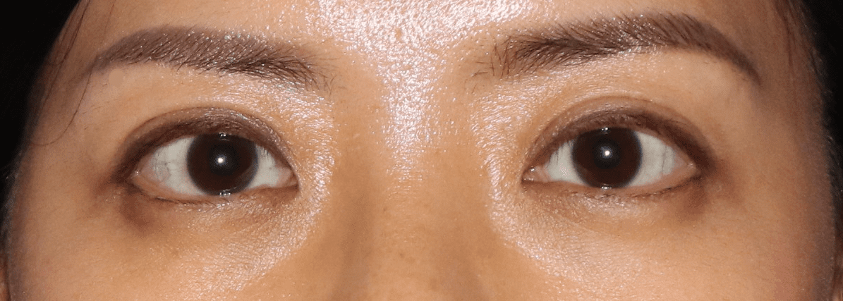 Beautiful Asian double eyelid