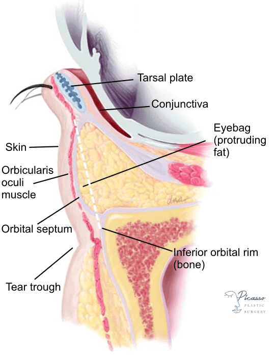 Cross section anatomy of the eyelid and eyebags (side)