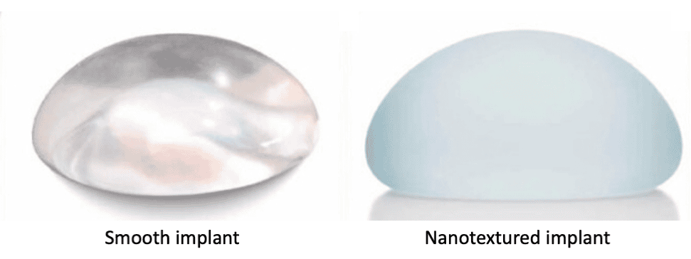 Do Silicone or Saline Implants Last Longer