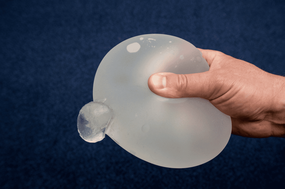What Happens If My Implant Ruptures